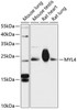 Western blot analysis of extracts of various cell lines, using MYL4 antibody (14-871) at 1:3000 dilution.<br/>Secondary antibody: HRP Goat Anti-Rabbit IgG (H+L) at 1:10000 dilution.<br/>Lysates/proteins: 25ug per lane.<br/>Blocking buffer: 3% nonfat dry milk in TBST.<br/>Detection: ECL Enhanced Kit.<br/>Exposure time: 10s.