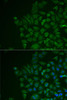 Immunofluorescence analysis of MCF7 cells using LRAT antibody (14-873) . Blue: DAPI for nuclear staining.