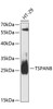 Western blot analysis of extracts of HT-29 cells, using TSPAN8 antibody (14-879) at 1:3000 dilution.<br/>Secondary antibody: HRP Goat Anti-Rabbit IgG (H+L) at 1:10000 dilution.<br/>Lysates/proteins: 25ug per lane.<br/>Blocking buffer: 3% nonfat dry milk in TBST.<br/>Detection: ECL Basic Kit.<br/>Exposure time: 30s.