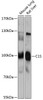 Western blot analysis of extracts of various cell lines, using C1S antibody (14-886) at 1:1000 dilution.<br/>Secondary antibody: HRP Goat Anti-Rabbit IgG (H+L) at 1:10000 dilution.<br/>Lysates/proteins: 25ug per lane.<br/>Blocking buffer: 3% nonfat dry milk in TBST.<br/>Detection: ECL Enhanced Kit.<br/>Exposure time: 90s.