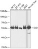 Western blot analysis of extracts of various cell lines, using DLD antibody (14-897) at 1:1000 dilution.<br/>Secondary antibody: HRP Goat Anti-Rabbit IgG (H+L) at 1:10000 dilution.<br/>Lysates/proteins: 25ug per lane.<br/>Blocking buffer: 3% nonfat dry milk in TBST.<br/>Detection: ECL Basic Kit.<br/>Exposure time: 5s.