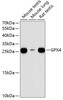 Western blot analysis of extracts of various cell lines, using GPX4 antibody (14-907) at 1:1000 dilution.<br/>Secondary antibody: HRP Goat Anti-Rabbit IgG (H+L) at 1:10000 dilution.<br/>Lysates/proteins: 25ug per lane.<br/>Blocking buffer: 3% nonfat dry milk in TBST.<br/>Detection: ECL Basic Kit.<br/>Exposure time: 90s.