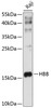 Western blot analysis of extracts of Raji cells, using HBB antibody (14-908) at 1:1000 dilution.<br/>Secondary antibody: HRP Goat Anti-Rabbit IgG (H+L) at 1:10000 dilution.<br/>Lysates/proteins: 25ug per lane.<br/>Blocking buffer: 3% nonfat dry milk in TBST.<br/>Detection: ECL Enhanced Kit.<br/>Exposure time: 10s.