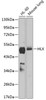 Western blot analysis of extracts of various cell lines, using HLX antibody (14-911) at 1:1000 dilution.<br/>Secondary antibody: HRP Goat Anti-Rabbit IgG (H+L) at 1:10000 dilution.<br/>Lysates/proteins: 25ug per lane.<br/>Blocking buffer: 3% nonfat dry milk in TBST.<br/>Detection: ECL Enhanced Kit.<br/>Exposure time: 30s.