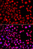 Immunofluorescence analysis of A549 cells using HLX antibody (14-911) . Blue: DAPI for nuclear staining.