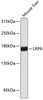 Western blot analysis of extracts of mouse liver, using LRP6 antibody (14-920) at 1:1000 dilution.<br/>Secondary antibody: HRP Goat Anti-Rabbit IgG (H+L) at 1:10000 dilution.<br/>Lysates/proteins: 25ug per lane.<br/>Blocking buffer: 3% nonfat dry milk in TBST.<br/>Detection: ECL Basic Kit.<br/>Exposure time: 60s.