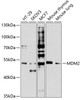Western blot analysis of extracts of various cell lines, using MDM2 antibody (14-921) at 1:1000 dilution.<br/>Secondary antibody: HRP Goat Anti-Rabbit IgG (H+L) at 1:10000 dilution.<br/>Lysates/proteins: 25ug per lane.<br/>Blocking buffer: 3% nonfat dry milk in TBST.<br/>Detection: ECL Basic Kit.<br/>Exposure time: 90s.