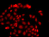 Immunofluorescence analysis of A549 cells using MLF1 antibody (14-923) .