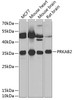 Western blot analysis of extracts of various cell lines, using PRKAB2 antibody (14-931) at 1:1000 dilution.<br/>Secondary antibody: HRP Goat Anti-Rabbit IgG (H+L) at 1:10000 dilution.<br/>Lysates/proteins: 25ug per lane.<br/>Blocking buffer: 3% nonfat dry milk in TBST.<br/>Detection: ECL Basic Kit.<br/>Exposure time: 90s.