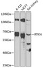 Western blot analysis of extracts of various cell lines, using RTKN antibody (14-937) at 1:1000 dilution.<br/>Secondary antibody: HRP Goat Anti-Rabbit IgG (H+L) at 1:10000 dilution.<br/>Lysates/proteins: 25ug per lane.<br/>Blocking buffer: 3% nonfat dry milk in TBST.<br/>Detection: ECL Basic Kit.<br/>Exposure time: 90s.