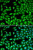 Immunofluorescence analysis of MCF-7 cells using RTKN antibody (14-937) . Blue: DAPI for nuclear staining.