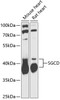 Western blot analysis of extracts of various cell lines, using SGCD antibody (14-939) at 1:1000 dilution.<br/>Secondary antibody: HRP Goat Anti-Rabbit IgG (H+L) at 1:10000 dilution.<br/>Lysates/proteins: 25ug per lane.<br/>Blocking buffer: 3% nonfat dry milk in TBST.<br/>Detection: ECL Basic Kit.<br/>Exposure time: 90s.