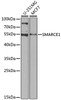 Western blot analysis of extracts of various cell lines, using SMARCE1 antibody (14-940) at 1:1000 dilution.<br/>Secondary antibody: HRP Goat Anti-Rabbit IgG (H+L) at 1:10000 dilution.<br/>Lysates/proteins: 25ug per lane.<br/>Blocking buffer: 3% nonfat dry milk in TBST.<br/>Detection: ECL Basic Kit.<br/>Exposure time: 90s.