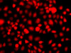 Immunofluorescence analysis of A549 cells using NR2E1 antibody (14-946) .