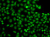 Immunofluorescence analysis of A549 cells using PIP5K1A antibody (14-955) .