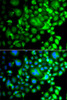 Immunofluorescence analysis of A549 cells using SNX3 antibody (14-960) . Blue: DAPI for nuclear staining.