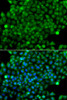 Immunofluorescence analysis of A549 cells using CFHR3 antibody (14-970) . Blue: DAPI for nuclear staining.