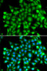 Immunofluorescence analysis of MCF-7 cells using SUFU antibody (14-985) . Blue: DAPI for nuclear staining.