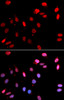 Immunofluorescence analysis of U2OS cells using RAD18 antibody (14-988) . Blue: DAPI for nuclear staining.