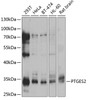 Western blot analysis of extracts of various cell lines, using PTGES2 antibody (14-991) at 1:1000 dilution.<br/>Secondary antibody: HRP Goat Anti-Rabbit IgG (H+L) at 1:10000 dilution.<br/>Lysates/proteins: 25ug per lane.<br/>Blocking buffer: 3% nonfat dry milk in TBST.<br/>Detection: ECL Basic Kit.<br/>Exposure time: 5s.