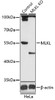 Western blot analysis of extracts from normal (control) and MLKL knockout (KO) HeLa cells, using MLKL antibody (14-995) at 1:1000 dilution.<br/>Secondary antibody: HRP Goat Anti-Rabbit IgG (H+L) at 1:10000 dilution.<br/>Lysates/proteins: 25ug per lane.<br/>Blocking buffer: 3% nonfat dry milk in TBST.<br/>Detection: ECL Basic Kit.<br/>Exposure time: 90s.