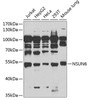 Western blot analysis of extracts of various cell lines, using NSUN6 antibody (14-996) at 1:1000 dilution.<br/>Secondary antibody: HRP Goat Anti-Rabbit IgG (H+L) at 1:10000 dilution.<br/>Lysates/proteins: 25ug per lane.<br/>Blocking buffer: 3% nonfat dry milk in TBST.<br/>Detection: ECL Enhanced Kit.<br/>Exposure time: 90s.