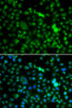 Immunofluorescence analysis of MCF-7 cells using NSUN6 antibody (14-996) . Blue: DAPI for nuclear staining.