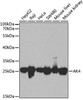 Western blot analysis of extracts of various cell lines, using AK4 antibody (15-003) at 1:1000 dilution.<br/>Secondary antibody: HRP Goat Anti-Rabbit IgG (H+L) at 1:10000 dilution.<br/>Lysates/proteins: 25ug per lane.<br/>Blocking buffer: 3% nonfat dry milk in TBST.