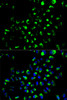 Immunofluorescence analysis of A549 cells using AK4 antibody (15-003) . Blue: DAPI for nuclear staining.