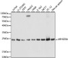 Western blot analysis of extracts of various cell lines, using ARHGDIA antibody (15-006) at 1:1000 dilution.<br/>Secondary antibody: HRP Goat Anti-Rabbit IgG (H+L) at 1:10000 dilution.<br/>Lysates/proteins: 25ug per lane.<br/>Blocking buffer: 3% nonfat dry milk in TBST.<br/>Detection: ECL Basic Kit.<br/>Exposure time: 3s.