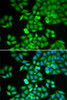 Immunofluorescence analysis of HeLa cells using ARHGDIA antibody (15-006) . Blue: DAPI for nuclear staining.