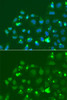 Immunofluorescence analysis of A549 cells using ATF3 antibody (15-007) . Blue: DAPI for nuclear staining.