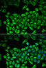 Immunofluorescence analysis of A549 cells using HAS3 antibody (15-025) . Blue: DAPI for nuclear staining.