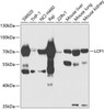 Western blot analysis of extracts of various cell lines, using LCP1 antibody (15-030) at 1:1000 dilution.<br/>Secondary antibody: HRP Goat Anti-Rabbit IgG (H+L) at 1:10000 dilution.<br/>Lysates/proteins: 25ug per lane.<br/>Blocking buffer: 3% nonfat dry milk in TBST.<br/>Detection: ECL Basic Kit.<br/>Exposure time: 5s.
