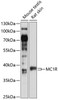 Western blot analysis of extracts of various cell lines, using MC1R antibody (15-034) at 1:1000 dilution.<br/>Secondary antibody: HRP Goat Anti-Rabbit IgG (H+L) at 1:10000 dilution.<br/>Lysates/proteins: 25ug per lane.<br/>Blocking buffer: 3% nonfat dry milk in TBST.<br/>Detection: ECL Basic Kit.<br/>Exposure time: 15s.