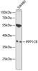 Western blot analysis of extracts of SW480 cells, using PPP1CB antibody (15-047) at 1:1000 dilution.<br/>Secondary antibody: HRP Goat Anti-Rabbit IgG (H+L) at 1:10000 dilution.<br/>Lysates/proteins: 25ug per lane.<br/>Blocking buffer: 3% nonfat dry milk in TBST.