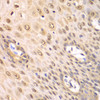 Immunohistochemistry of paraffin-embedded human esophagus using PSMA2 antibody (15-049) at dilution of 1:100 (40x lens) .