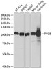 Western blot analysis of extracts of various cell lines, using PYGB antibody (15-054) at 1:1000 dilution.<br/>Secondary antibody: HRP Goat Anti-Rabbit IgG (H+L) at 1:10000 dilution.<br/>Lysates/proteins: 25ug per lane.<br/>Blocking buffer: 3% nonfat dry milk in TBST.<br/>Detection: ECL Basic Kit.<br/>Exposure time: 30s.