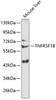 Western blot analysis of extracts of mouse liver, using TNFRSF1B antibody (15-066) at 1:1000 dilution.<br/>Secondary antibody: HRP Goat Anti-Rabbit IgG (H+L) at 1:10000 dilution.<br/>Lysates/proteins: 25ug per lane.<br/>Blocking buffer: 3% nonfat dry milk in TBST.