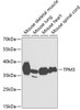 Western blot analysis of extracts of various cell lines, using TPM3 antibody (15-067) at 1:1000 dilution.<br/>Secondary antibody: HRP Goat Anti-Rabbit IgG (H+L) at 1:10000 dilution.<br/>Lysates/proteins: 25ug per lane.<br/>Blocking buffer: 3% nonfat dry milk in TBST.