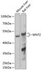 Western blot analysis of extracts of various cell lines, using WNT2 Antibody (15-071) at 1:1000 dilution.<br/>Secondary antibody: HRP Goat Anti-Rabbit IgG (H+L) at 1:10000 dilution.<br/>Lysates/proteins: 25ug per lane.<br/>Blocking buffer: 3% nonfat dry milk in TBST.<br/>Detection: ECL Basic Kit.<br/>Exposure time: 10s.