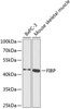 Western blot analysis of extracts of various cell lines, using FIBP antibody (15-076) at 1:1000 dilution.<br/>Secondary antibody: HRP Goat Anti-Rabbit IgG (H+L) at 1:10000 dilution.<br/>Lysates/proteins: 25ug per lane.<br/>Blocking buffer: 3% nonfat dry milk in TBST.<br/>Detection: ECL Basic Kit.<br/>Exposure time: 90s.