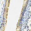 Immunohistochemistry of paraffin-embedded rat lung using ACSS2 Antibody (15-095) at dilution of 1:100 (40x lens) .