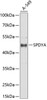 Western blot analysis of extracts of A549 cells, using SPDYA antibody (15-101) at 1:1000 dilution.<br/>Secondary antibody: HRP Goat Anti-Rabbit IgG (H+L) at 1:10000 dilution.<br/>Lysates/proteins: 25ug per lane.<br/>Blocking buffer: 3% nonfat dry milk in TBST.<br/>Detection: ECL Enhanced Kit.<br/>Exposure time: 10s.