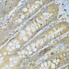 Immunohistochemistry of paraffin-embedded rat intestine using SERPINA6 Antibody (15-102) at dilution of 1:100 (40x lens) .