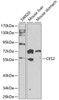 Western blot analysis of extracts of various cell lines, using CES2 antibody (15-121) at 1:1000 dilution.<br/>Secondary antibody: HRP Goat Anti-Rabbit IgG (H+L) at 1:10000 dilution.<br/>Lysates/proteins: 25ug per lane.<br/>Blocking buffer: 3% nonfat dry milk in TBST.