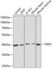 Western blot analysis of extracts of various cell lines, using TWF2 antibody (15-123) at 1:1000 dilution.<br/>Secondary antibody: HRP Goat Anti-Rabbit IgG (H+L) at 1:10000 dilution.<br/>Lysates/proteins: 25ug per lane.<br/>Blocking buffer: 3% nonfat dry milk in TBST.<br/>Detection: ECL Basic Kit.<br/>Exposure time: 180s.