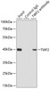 Immunoprecipitation analysis of 200ug extracts of 293T cells using 1ug TWF2 antibody (15-123) . Western blot was performed from the immunoprecipitate using TWF2 antibody (15-123) at a dilition of 1:1000.