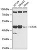 Western blot analysis of extracts of various cell lines, using CPA6 antibody (15-125) at 1:1000 dilution.<br/>Secondary antibody: HRP Goat Anti-Rabbit IgG (H+L) at 1:10000 dilution.<br/>Lysates/proteins: 25ug per lane.<br/>Blocking buffer: 3% nonfat dry milk in TBST.<br/>Detection: ECL Enhanced Kit.<br/>Exposure time: 90s.