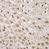 Immunohistochemistry of paraffin-embedded human esophagus using INTS5 antibody (15-126) at dilution of 1:100 (40x lens) .